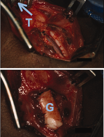 Fig. 10.