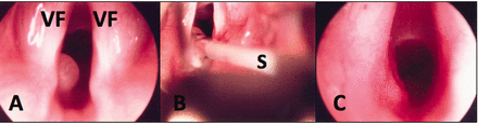 Fig. 11.