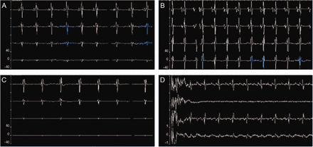 Fig. 2.