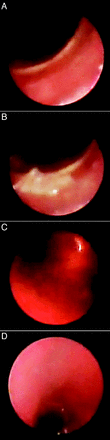 Fig. 3.