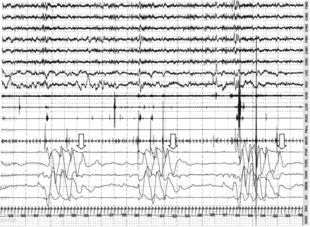 Fig. 1.