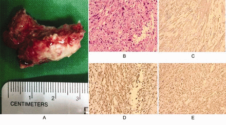 Fig. 3.