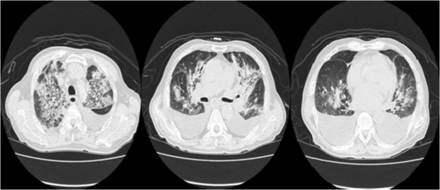 Fig. 2.