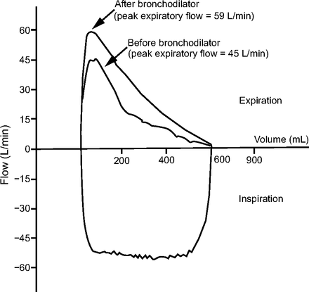 Fig. 12.