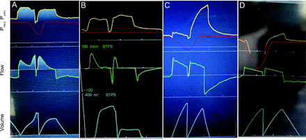 Fig. 12.