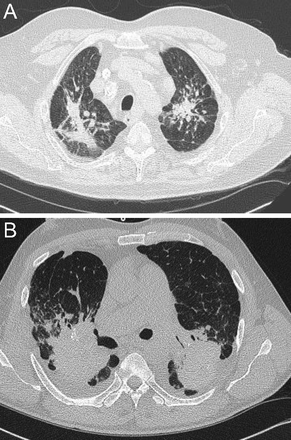 Fig. 10.