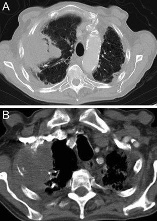 Fig. 11.