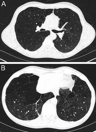 Fig. 13.