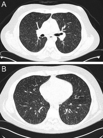 Fig. 14.