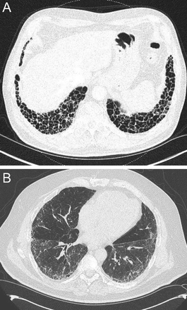 Fig. 15.