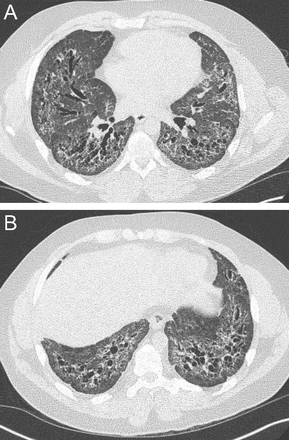 Fig. 16.