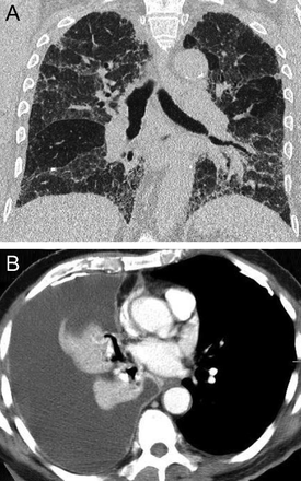 Fig. 17.