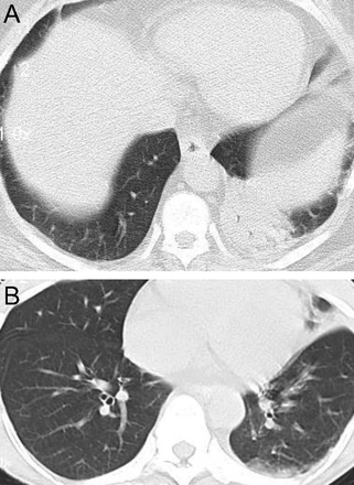 Fig. 18.