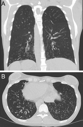 Fig. 19.