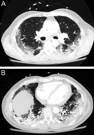 Fig. 20.