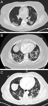 Fig. 21.