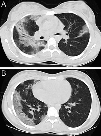 Fig. 22.